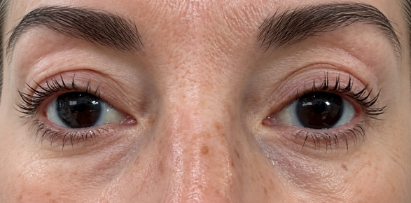 Controlled trial close-up of participant's eyes, Kristina.